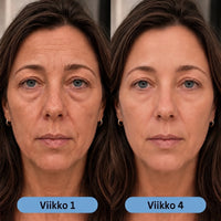 Ennen ja jälkeen: viikko 1 ja 4
