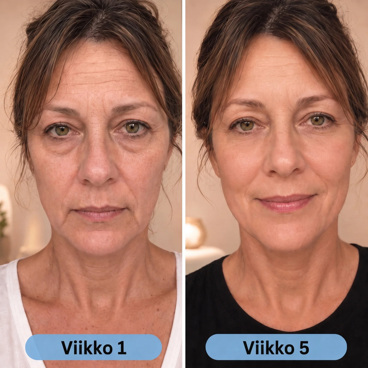 Ennen ja jälkeen: viikko 1 ja 5