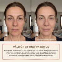 Veniiva Seerumi