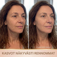 Veniiva Seerumi